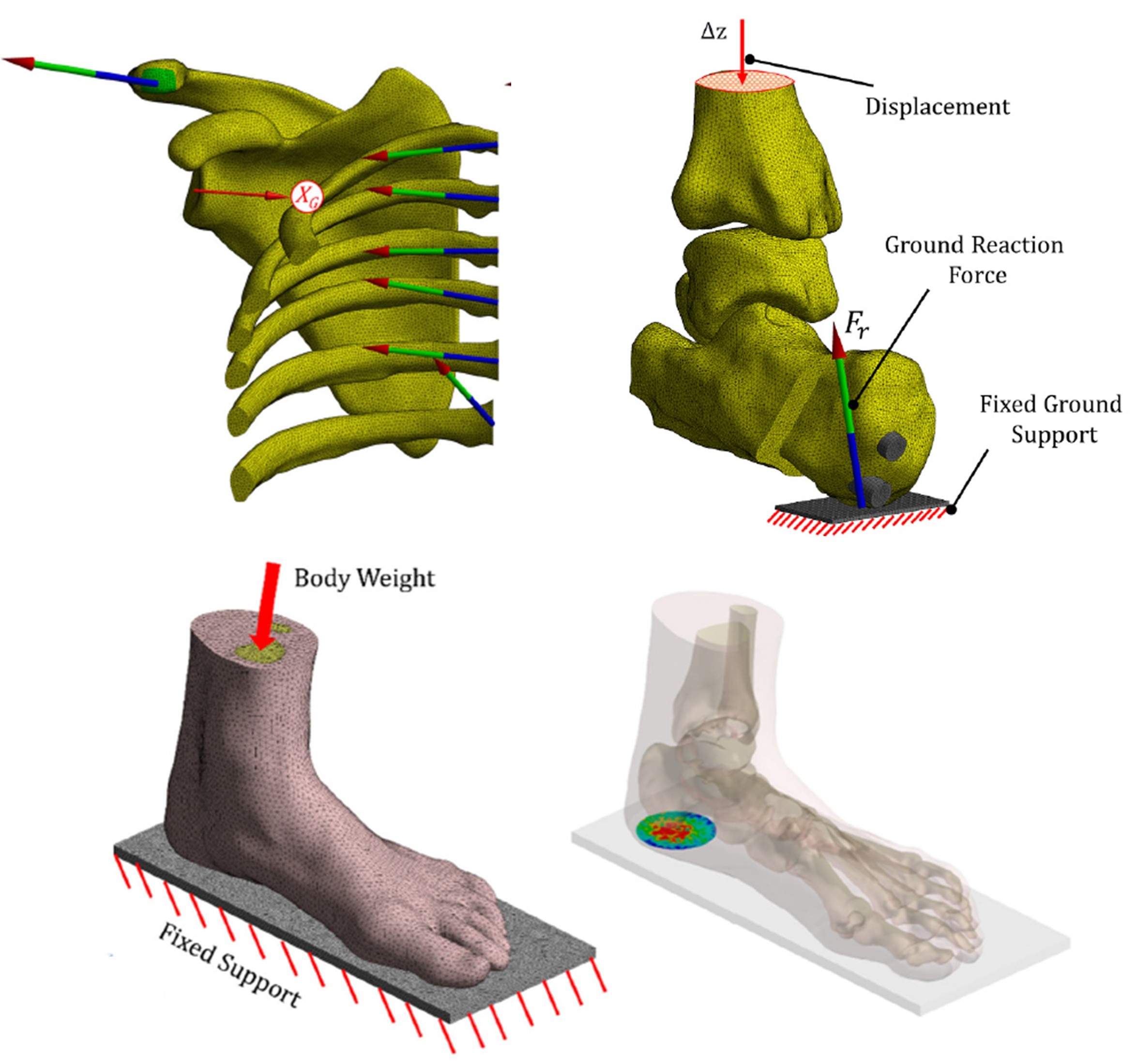 Computational biomechanics