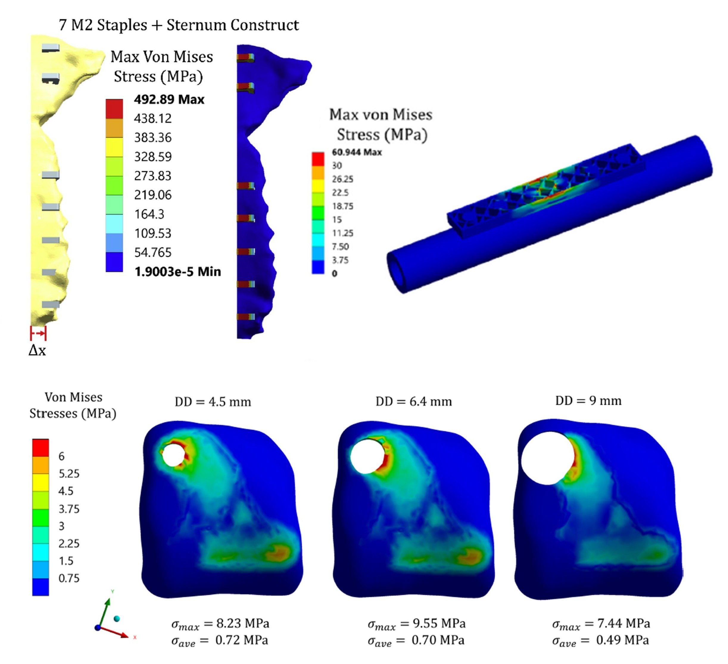 Finite element modeling