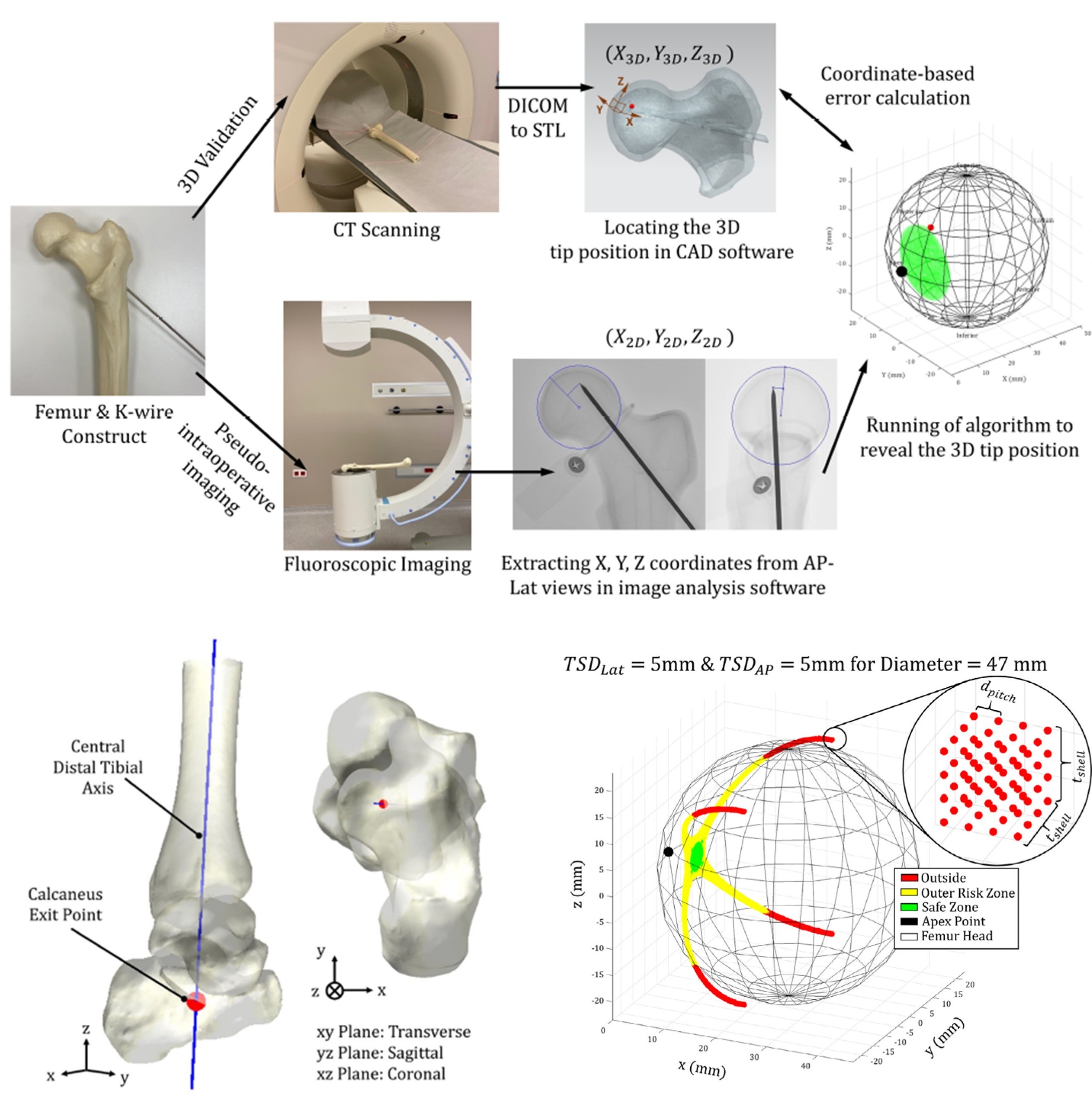 Orthopaedic engineering
